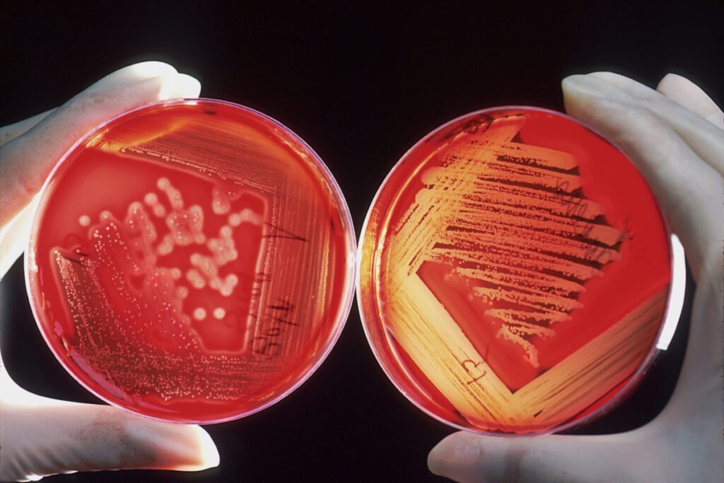 two ager plates showing positive staph infection