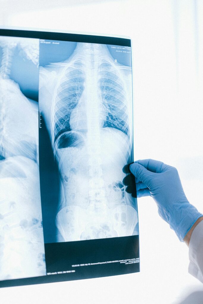 X-ray of a torso