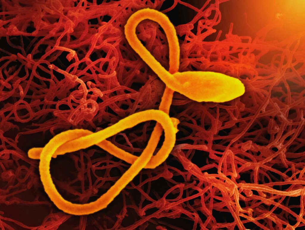 Ebola Virus Creative artwork featuring a scanning electron micrograph of a single filamentous Ebola virus particle (colorized yellow and orange) in the foreground, and a second scanning electron micrograph of filamentous Ebola virus particles (red) budding from a chronically infected VERO E6 cells in the background.